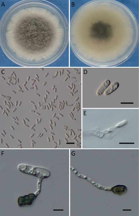 果生刺盘孢colletotrichum fructicola(pgysq06)特征